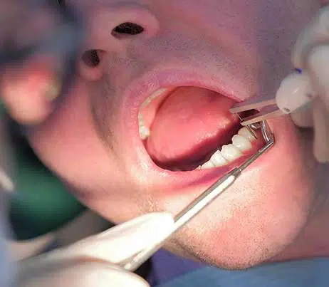 CD Dentist Checking Gums