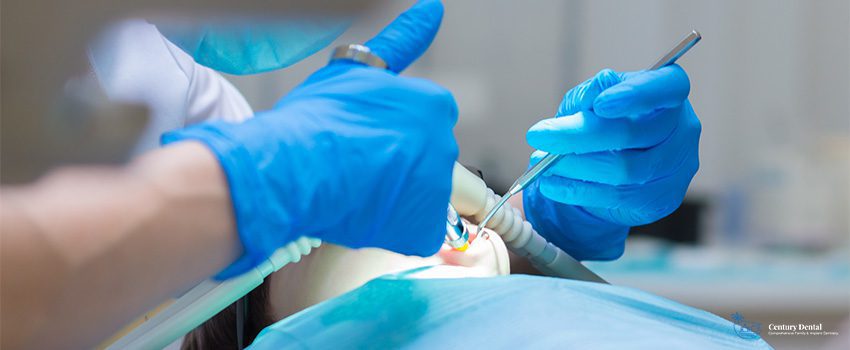 7 Questions to Ask Your Dentist Before Deep Sedation