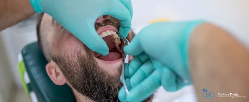 CD - Man getting tooth extracted