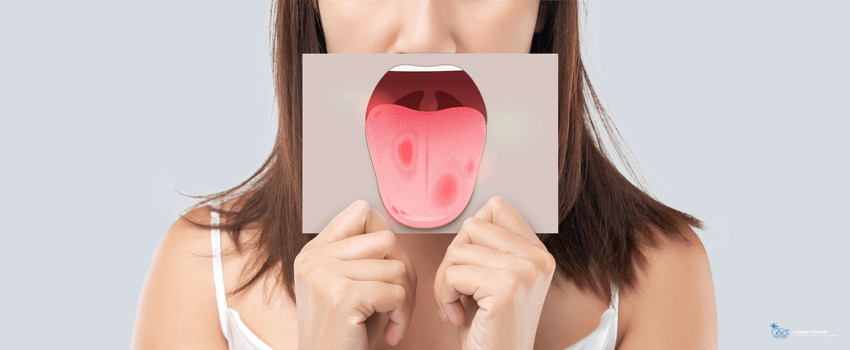 CD-The woman show the picture of tongue problems