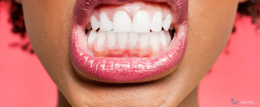 CD-Woman clenching her teeth