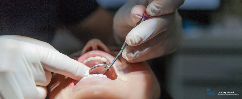 CD - Woman getting an oral surgery