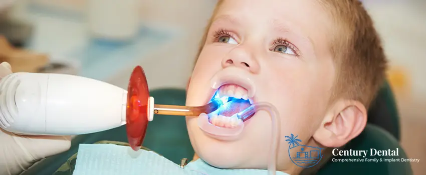 CD Tooth Bonding - Everything You Need to Know Before the Procedure